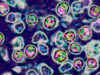 250221-measles-virus-lm-145-047eb9.jpg